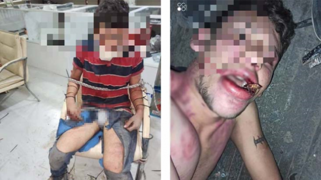 Antalya’da Dehşet Veren İşkence: Maaşını İsteyen Gence Korkunç Muamele